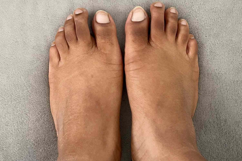 If you’re hard on your feet, chances are it shows as dry skin, cracked heels, or hardened calluses. To revive rough feet, a foot peel or mask is an easy, low effort way to get ready for summer sandals. These InStyle editor-tested picks are proven to make feet smooth, soft, and—dare we say it—sexy.