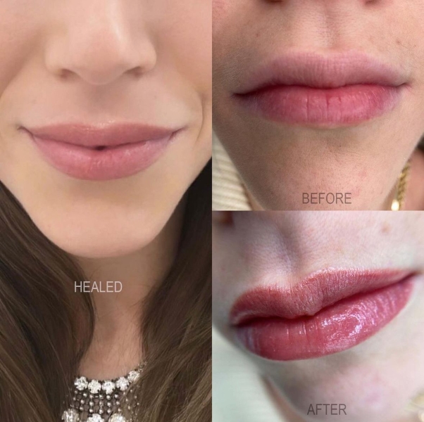 Lip blushing is a permanent cosmetic tattoo designed to perfect the appearance of the pout. Here, lip blushing tattoo artists reveal the benefits and side effects of the treatment.